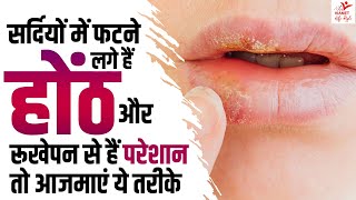 सर्दियों में फटने लगे हैं होंठ तो आजमाएं ये तरीका  Chapped Lips  Dry Lips Treatment At Home [upl. by Annoirb]