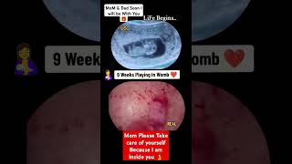 9 Weeks Baby Growing Inside Womb Pregnancy Ultrasound baby pregnancy babyboy babygirl boy [upl. by Aicekan]