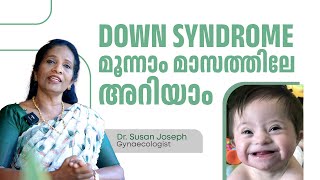 Down syndrome മൂന്നാം മാസത്തിലേ അറിയാം  Dr Susan Joseph [upl. by Whiteley779]