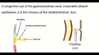 Embryology of vitellointestinal duct  formation fate amp congenital anomalies [upl. by Pillsbury564]