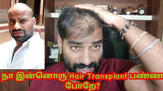 நா இன்னொரு Hair Transplant பண்ண போறேTamil Hair TransplantTamilan Hair Transplant [upl. by Faxan929]