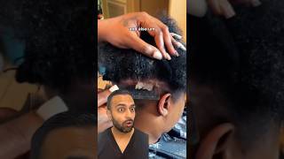 The Importance Of Treating Scalp Psoriasis  Dr Somji Explains [upl. by Bradeord897]