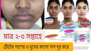 জেদি কালো দাগ দূর করে নিমিষেই  palmers skin success antidark spot fade cream khadija begum [upl. by Qerat]