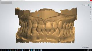 Webinar Making Clear Aligners Using the 3Shape Ortho System Module with Brandon Smith CDT [upl. by Cora]