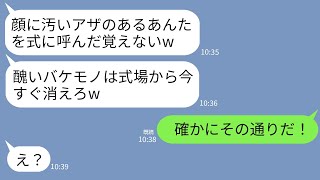 【LINE】尊敬する兄の結婚式で生まれつき顔にアザのある私を化け物扱いする兄嫁「醜いお前は今すぐ帰れw」兄「確かにその通りだ」→兄の一言で兄嫁は何もかも失う羽目にwww [upl. by Siuqramed]