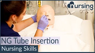 NG Nasogastric Tube Insertion Techniques Nursing Skills [upl. by Kynan606]