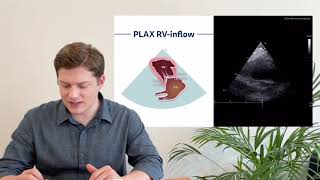 〖Echocardiography〗 Parasternal Long Axis View PLAX part 3  atypical views 1 [upl. by Rakso]