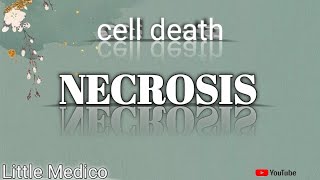 Necrosis and types of necrosis pathology robbins [upl. by Shaper]