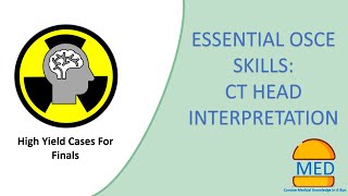 ESSENTIAL OSCE SKILLS CT HEAD INTERPRETATION with high yield examples [upl. by Greenland]