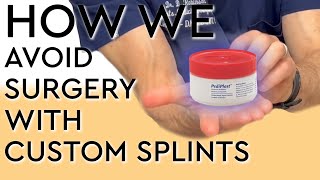 How We Avoid Surgery with Custom Splints [upl. by Livesay]