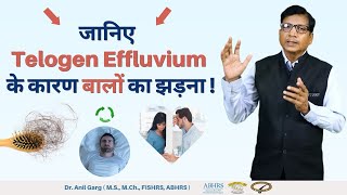 तेजी से बाल झड़ने का कारण Telogen Effluvium Disorder और उसका इलाज  गंजापन का इलाज  by Dr Garg [upl. by Blinny220]