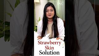 Strawberry Skin Treatment  Keratosis Pilaris  Dos and don’t to treat [upl. by Stubstad921]