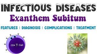 Exanthem Subitum  Viral Infections  Infectious Diseases 4  Medicine [upl. by Zaremski592]