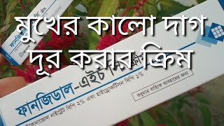 ত্বকে Fungidal HC cream এর কাজ কি  ব্রণ সহ ত্বকের যে কোন সমস্যায় ক্রিম টি ব্যবহার করার নিয়ম [upl. by Aerdua]