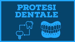 Quanto costa un impianto dentale in Italia [upl. by Latsyc544]