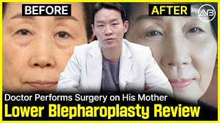 I Personally Performed My Mothers Plastic Surgery  Before amp After  AB Plastic Surgery [upl. by Kensell]