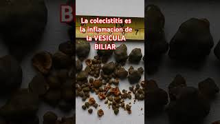 La colecistitis es la inflamacion de la VESICULA BILIAR [upl. by Annal]