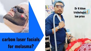 carbon laser facials for melasma  kala daag tik karne ka illaj  black mark removal treatment malda [upl. by Dot]