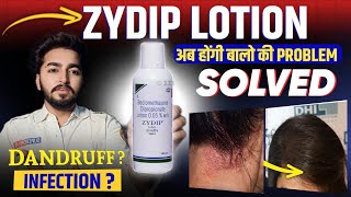 Zydip Lotion Review  Zydip Lotion For Hair [upl. by Etyam]