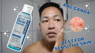 OXECURE ULTRA GENTLE FACIAL CLEANSER REVIEW FOR ONE MONTH  BEST FOR SENSITIVE SKIN AND BREAKOUTS [upl. by Nylcoj]