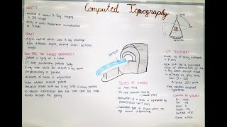 Computed Tomography CT  Device Houndsfield Units Mechanism of Function [upl. by Breh]