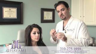 Custom Ethnic hispanic Rhinoplasty By Dr Ghavami [upl. by Sebastien]