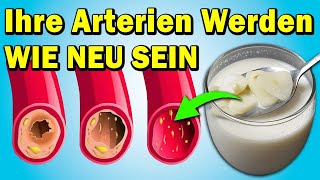 Reinigen Sie in 7 Tagen Ihre Arterien und entfernen Sie schlechtes Cholesterin mit diesem Rezept [upl. by Ennovehs510]