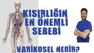 Varikosel Nedir ve Neden Olur [upl. by Ilanos]