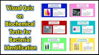 Visual Quiz on Biochemical tests for identification of bacteria  basicappliedmicrobiology [upl. by Iatnohs]