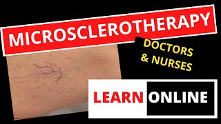 Online Microsclerotherapy Courses  How to Learn Micro Sclerotherapy Online [upl. by Nordin]