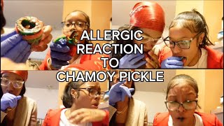 ALLERGIC REACTION TO VIRAL CHAMOY PICKEL REVIEW 😳 FT MY SISTER [upl. by Anihsat]