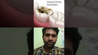 teeth teethwhitening dentistry doctor teeths dentist [upl. by Zilla606]