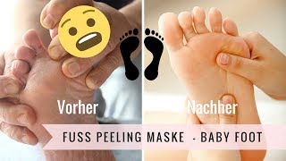 Fuß Peeling Maske  Entfernung von Hornhaut [upl. by Aramas987]