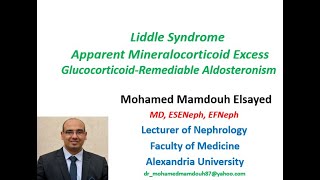 Liddle syndrome Apparent Mineralocorticoid Excess GlucocorticoidRemediable Aldosteronism [upl. by Ttenyl]