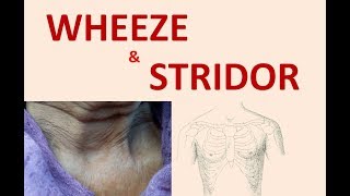 Wheeze and Stridor Sound [upl. by Willette]