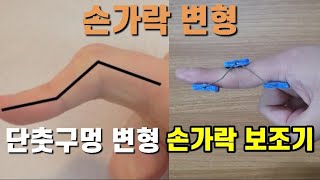 손가락 변형 손가락 보조기 리뷰 boutonniere deformity orthosis 단춧구멍 변형 류마티스 손가락 관절염 손가락 통증 [upl. by Purdum]