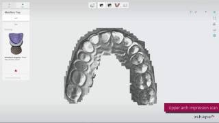 3Shape impression scanning [upl. by Hilleary]