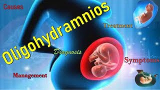 Oligohydramnios Causes Pathophysiology Symptoms Diagnosis Complications and Treatment [upl. by Bowden]