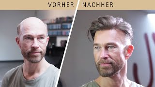 Herren Haarsystem Moderne Frisuren amp Stylische Zweithaarlösungen für den Mann von heute [upl. by Stoeber648]