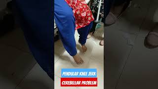 Pendular Knee jerk in cerebellum lesiondiseasediagnosiscerebellum [upl. by Akelahs478]