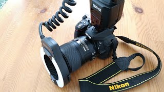 Dental Photography Settings for Nikon Camera DSLR [upl. by Bertsche]