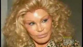 How Much Plastic Surgery did Cat Lady Jocelyn Wildenstein Have Done [upl. by Voleta150]