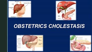 Obstetric Cholestasis RCOG Guideline [upl. by Eicaj]