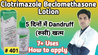 Candid B lotion  Candid B lotion for hair dandruff  Clotrimazole beclomethasone lotion [upl. by Aserret]