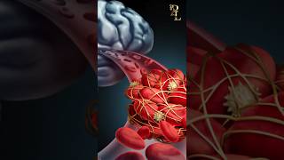 Science Of Stroke stroke shorts strokeeducation strokesupport [upl. by Lonnie]