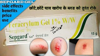 Sepgard gel use सेपगार्ड जेल यूज कैसे करे  how to sepgard gel use for surgery sepgard gel benefit [upl. by Warp]