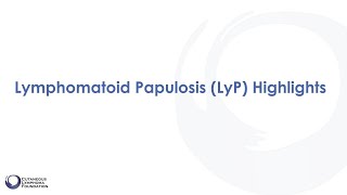 Diagnosis Lymphomatoid Papulosis [upl. by Kora442]