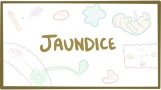 Jaundice  causes treatment amp pathology [upl. by Kindig640]