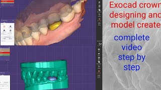 Exocad 30 Galway  How to Make ModelsMaking Models in ExocadExocad Model creatorexocad design [upl. by Edge736]