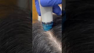 Best Solution For Dandruff  Dadu Medical Centre [upl. by Onaivlis]